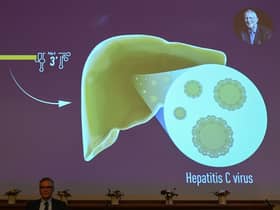 Hepatitis C cure will now be available to under-12s on NHS in ‘world first’ (Photo by JONATHAN NACKSTRAND/AFP via Getty Images)
