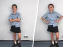 Toby has worn a skirt to school in protest of the school’s dress code which stops male students wearing shorts.  (SWNS)