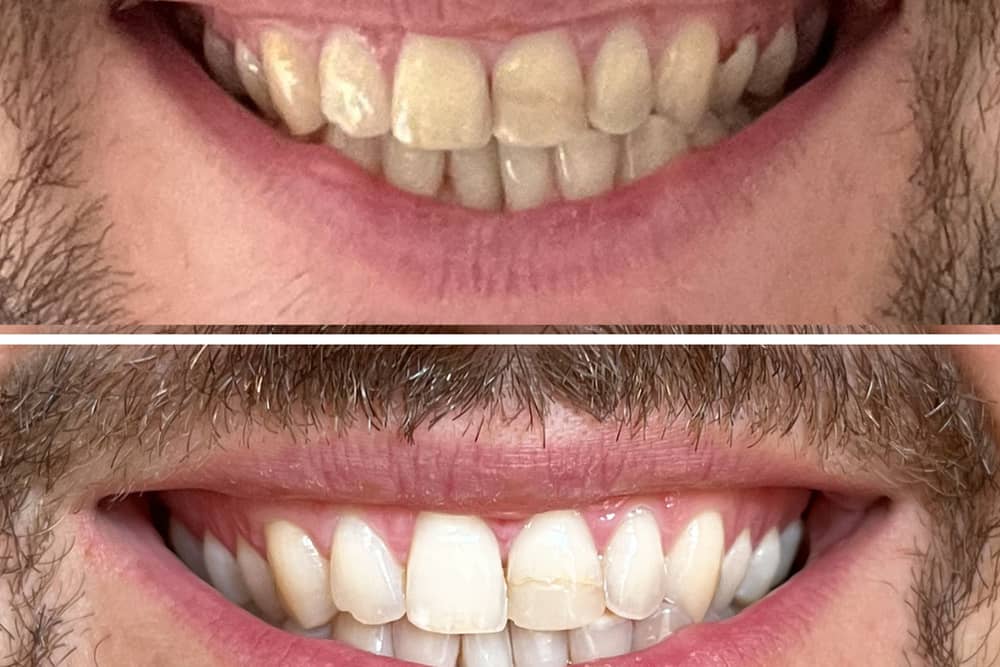 MySweetSmile claims to help put the white back in anyone's smile