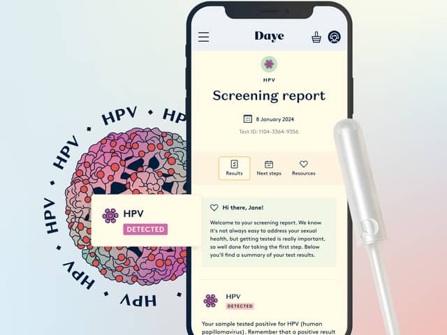 Daye have released the world's first HPV screening tampon. (Photo: Daye)