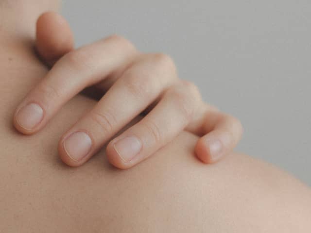 Could you tell the difference between a harmless rash from a fatal illness? (Photo: Pexel, Ximena Mora)