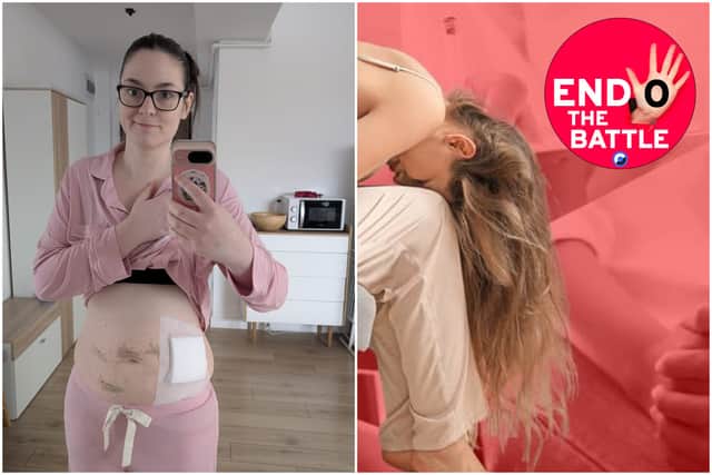 Laurene recently travelled to Bucharest in Romania to have surgery for endometriosis.