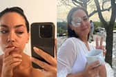 Northern Ireland woman woke up with a badly swollen eye on her wedding day after being bit by an insect.