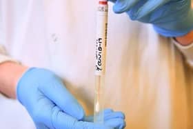 Rise in COVID-19 cases in Derry and Strabane.