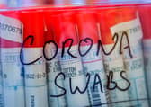 COVID-19 swabs