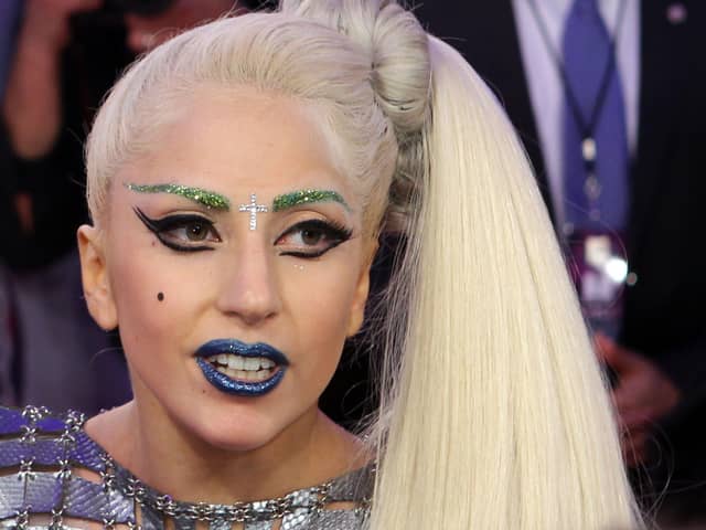 Lady Gaga was said to be ‘heartbroken’ by the theft of her dogs.