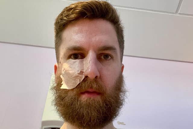 James Anthony in hospital after the tumour was removed.