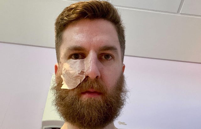 James Anthony in hospital after the tumour was removed.