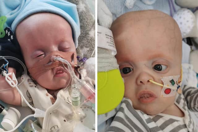 Reid while on the ventilator and on the right a few short weeks after he started experimental medication.