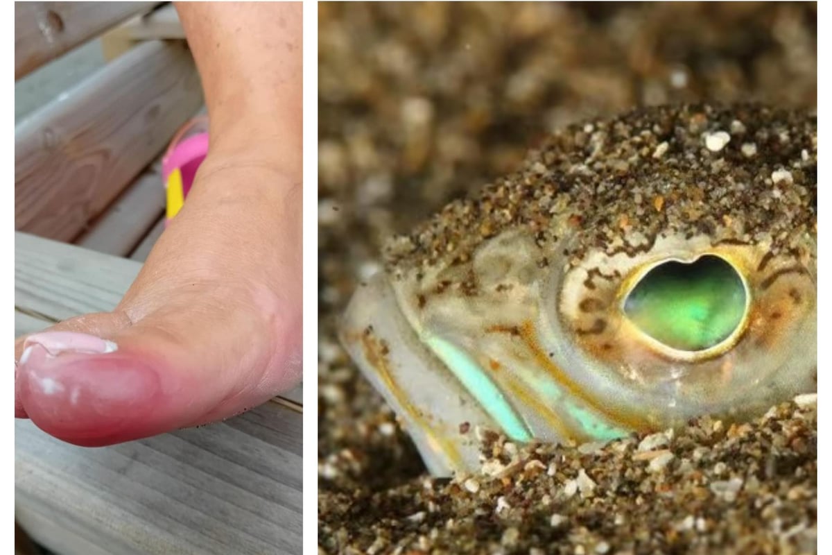 Warning issued after woman 'badly stung' by weever fish at Linsfort Beach