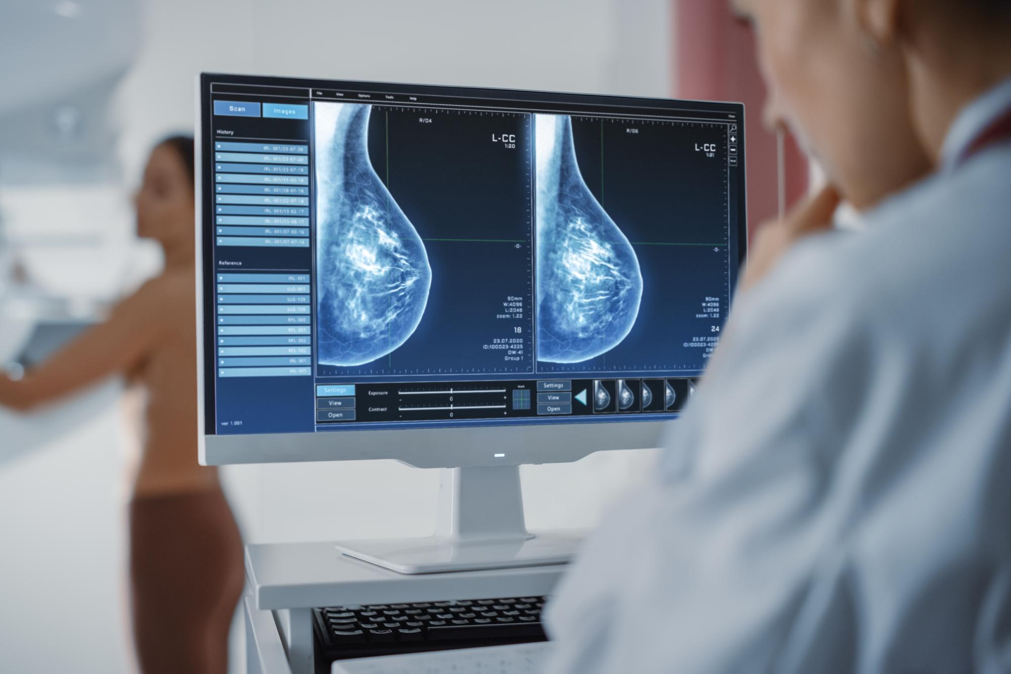 Nesbitt: New breast cancer service has reduced variation between WHSCT ...