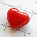 More than 7 million people in the United Kingdom are living with cardiovascular disease with about 100,000 having a heart attack and more than 100,000 having a stroke every year.