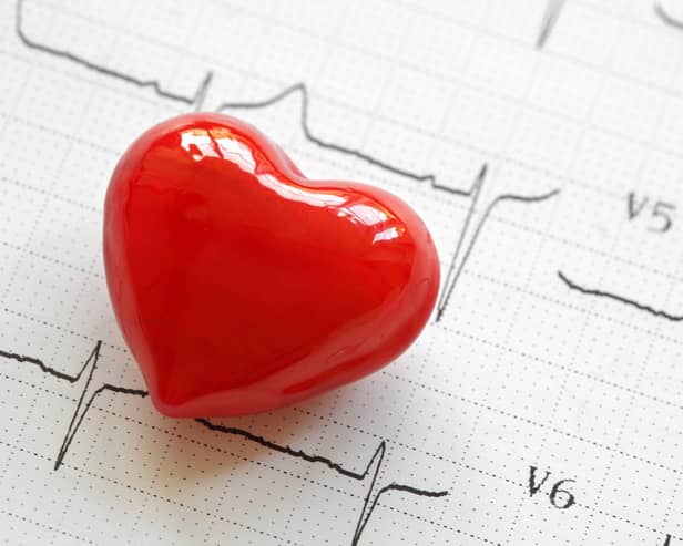 More than 7 million people in the United Kingdom are living with cardiovascular disease with about 100,000 having a heart attack and more than 100,000 having a stroke every year.