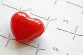 More than 7 million people in the United Kingdom are living with cardiovascular disease with about 100,000 having a heart attack and more than 100,000 having a stroke every year.