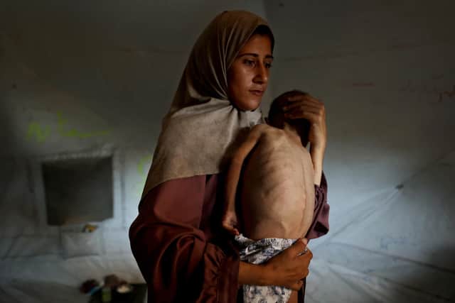 TOPSHOT - Hidaya, a 31-year-old Palestinian mother, carries her sick  18-month-old son Mohammed al-Mutawaq, who is also displaying signs of malnutrition, inside their tent at the Al-Shati refugee camp, west of Gaza City, on July 24, 2025. More than 100 aid organisations and human rights groups warned on July 23, that "mass starvation" was spreading in Gaza, as the United States said its top envoy was heading to Europe for talks on a possible ceasefire and aid corridor. (Photo by Omar AL-QATTAA / AFP) (Photo by OMAR AL-QATTAA/AFP via Getty Images)           : Hidaya, a 31-year-old Palestinian mother, carries her sick 18-month-old son Mohammed al-Mutawaq, who is also displaying signs of malnutrition, inside their tent at the Al-Shati refugee camp, west of Gaza City, on July 24, 2025. More than 100 aid organisations and human rights groups warned on July 23, that "mass starvation" was spreading in Gaza, as the United States said its top envoy was heading to Europe for talks on a possible ceasefire and aid corridor. (Photo by Omar AL-QATTAA / AFP) (Photo by OMAR AL-QATTAA/AFP via Getty Images)