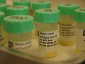 The Western Trust’s Human Milk Bank service based at the South West Acute Hospital, Enniskillen is making a fresh appeal for more donor mums to come forward and help to provide essential lifesaving donor breast milk for babies in Neonatal Units in hospitals throughout the whole of Ireland.