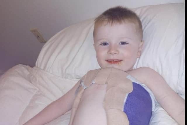 Little Patrick Burke after getting his first cast in America to treat his scoliosis.