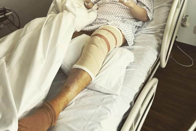 Portsmouth striker Ronan Curtis pictured after his successful operation on his left knee.