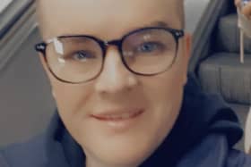 Chris Dawson (38) successfully underwent surgery to cancer that had developed from a mole on his leg three months ago.