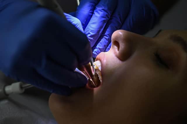 Derry City and Strabane had the highest rate of children treated for fillings, crowns or extractions in the north in 2022/23 with 223 per 1,000, new dental statistics show. (Photo by Ozan KOSE / AFP) (Photo by OZAN KOSE/AFP via Getty Images)