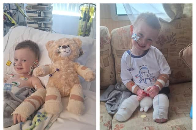 Dáibhin McConnell-Mailey on left, in hospital and on right, recently at home.