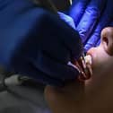 A former Derry dentist has described decay as a ‘disease of deprivation’ highlighting disproportionately higher levels of illness and tooth extraction in the North compared with Britain.