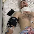 For eight days, Aidan Griffin has been receiving emergency medical care in a hospital in Kuta in the south of Bali, Indonesia, leaving his family and friends fraught with anxiety.