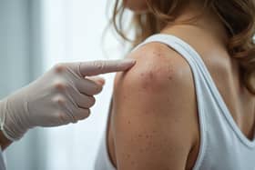 Western Trust reliant on single dermatology consultant to deal with red flag skin cancer appointments, says Mike Nesbitt