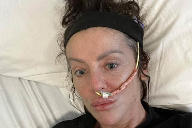 Bernie during her recovery.