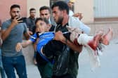 An injured Palestinian boy is rushed into the Nasser hospital after Israeli forces targeted the north eastern district of Khan Yunis, in the southern Gaza Strip, on July 24, 2024. Photo by BASHAR TALEB/AFP via Getty Images)