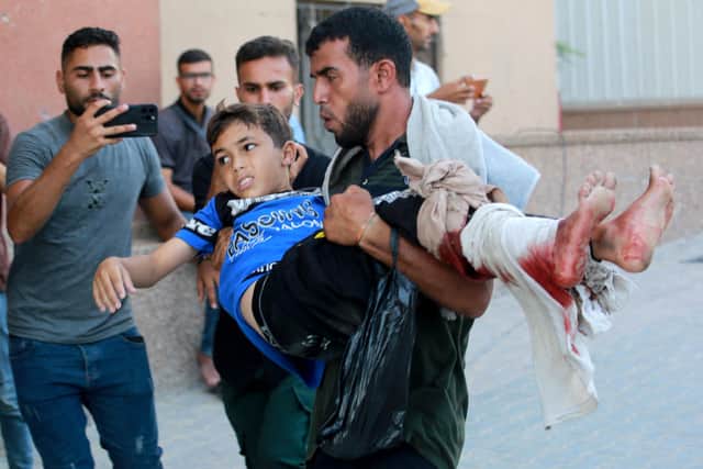 An injured Palestinian boy is rushed into the Nasser hospital after Israeli forces targeted the northeastern district of Khan Yunis, in the southern Gaza Strip, on July 24, 2024, amid the ongoing conflict between Israel and the Palestinian militant group Hamas. Israel bombarded Gaza on July 24, including the southern city of Khan Yunis, where it had ordered a partial evacuation of civilians. (Photo by Bashar TALEB / AFP) (Photo by BASHAR TALEB/AFP via Getty Images)