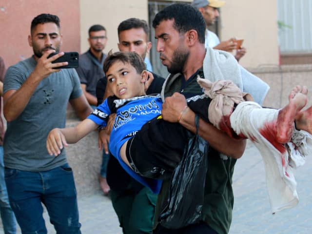 An injured Palestinian boy is rushed into the Nasser hospital after Israeli forces targeted the northeastern district of Khan Yunis, in the southern Gaza Strip, on July 24, 2024, amid the ongoing conflict between Israel and the Palestinian militant group Hamas. Israel bombarded Gaza on July 24, including the southern city of Khan Yunis, where it had ordered a partial evacuation of civilians. (Photo by Bashar TALEB / AFP) (Photo by BASHAR TALEB/AFP via Getty Images)