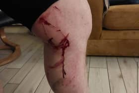 A cyclist has suffered gashes to his leg after coming his bicycle while trying to avoid trees felled by Storm Éowyn out the ‘Line’ in Derry.