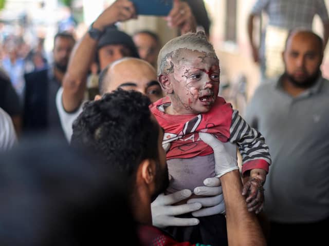 KHAN YOUNIS, GAZA - OCTOBER 16: Palestinian children injured during Israeli raids in the southern Gaza Strip arrive on October 16, 2023 in Khan Yunis, Gaza. Gazans are evacuating to the south following warnings to do so from the Israeli government, ahead of an expected Israeli ground offensive. Israel has sealed off Gaza and launched sustained retaliatory air strikes, which have killed at least 2,500 people with more than 400,000 displaced, after a large-scale attack by Hamas. On October 7, the Palestinian militant group Hamas launched a surprise attack on Israel from Gaza by land, sea, and air, killing over 1,300 people and wounding around 2,800. Israeli soldiers and civilians have also been taken hostage by Hamas and moved into Gaza. The attack prompted a declaration of war by Israeli Prime Minister Benjamin Netanyahu and the announcement of an emergency wartime government. (Photo by Ahmad Hasaballah/Getty Images)