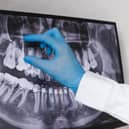 No dental practices in Derry have signed up to a scheme to deliver urgent dental care to unregistered patients, it’s been revealed.