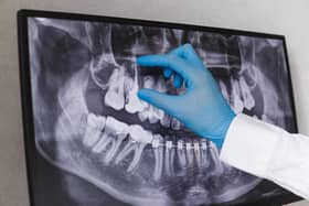No dental practices in Derry have signed up to a scheme to deliver urgent dental care to unregistered patients, it’s been revealed.