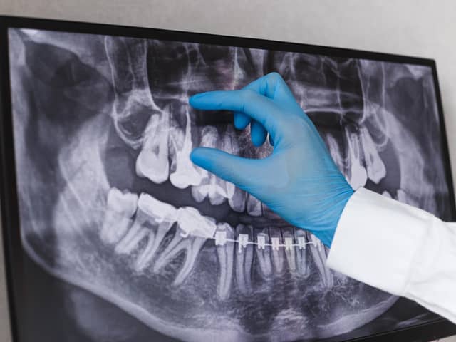 No dental practices in Derry have signed up to a scheme to deliver urgent dental care to unregistered patients, it’s been revealed.