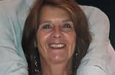 Linda Davis, 71, was in Southwell Road East, Rainworth, when she was hit by a privately-owned electric scooter.