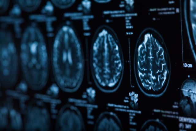 The ‘Tackling Waiting Lists’ report looked at the situation across the North and found demand variance between Trusts across specialisms and that the Western Trust had the longest waits for neurology.