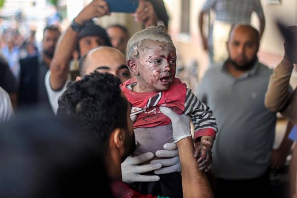KHAN YOUNIS, GAZA - OCTOBER 16: Palestinian children injured during Israeli raids in the southern Gaza Strip arrive on October 16, 2023 in Khan Yunis, Gaza. (Photo by Ahmad Hasaballah/Getty Images)