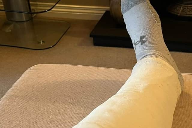 The leg of an officer who suffered a dislocated knee following an assault in January.