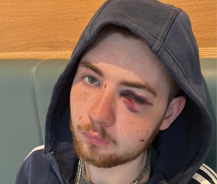Derry man (21) remains 'traumatised' after assault that 'shifted' his ...