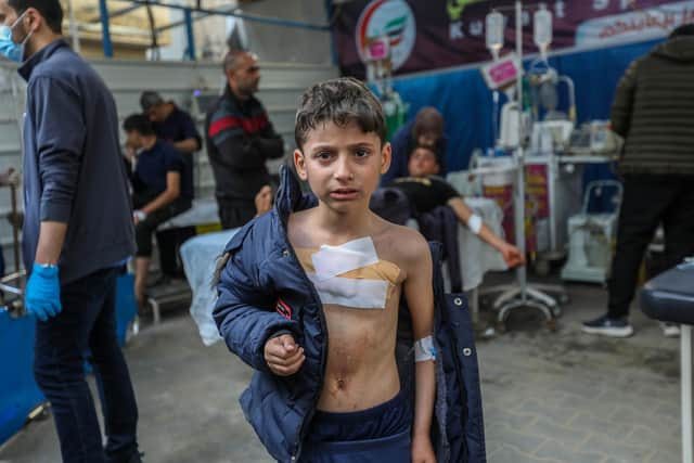 RAFAH, GAZA - JANUARY 8: A young Palestinian injured in Israeli air strikes is treated at Kuwait Hospital on January 08, 2024 in Rafah, Gaza. Despite Israel's recent troop drawdown in Gaza and the discussion of postwar plans by an Israeli cabinet minister, the country has continued its intensive bombardment of the Gaza Strip, particularly in the territory's south, as it seeks to destroy Hamas, the Palestinian militant group behind the Oct. 7 attacks. More than 22,000 people have been killed in Gaza in the last three months, according to the territory's health ministry, and most of the population has been displaced.(Photo by Ahmad Hasaballah/Getty Images)