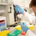 The Personalised Medicine Centre aims to develop clinical tools and therapies tailored to a person’s unique genetic and molecular profile.