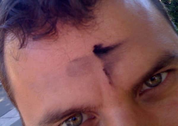 Ash Wednesday (Picture by Corey Taratuta, flikr.com)