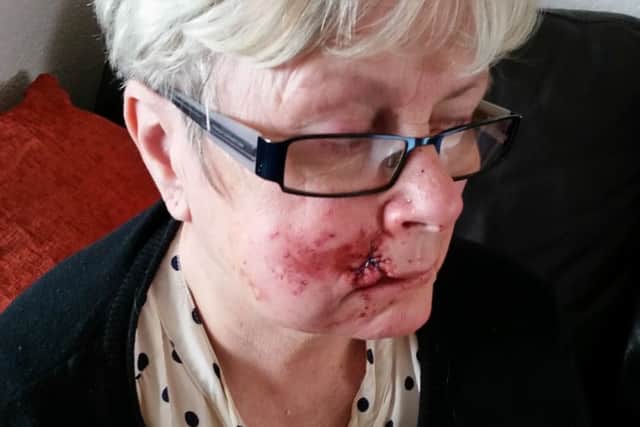 Sandra Major lost four teeth and needed 30 stitches after the attack in Dungiven.