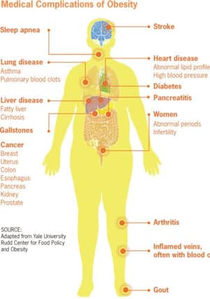 Some of the health implications with obesity