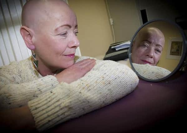 Paula Kyle pictured before receiving her treatment. See Friday's Journal for the results. Photograph by Jim McCafferty.