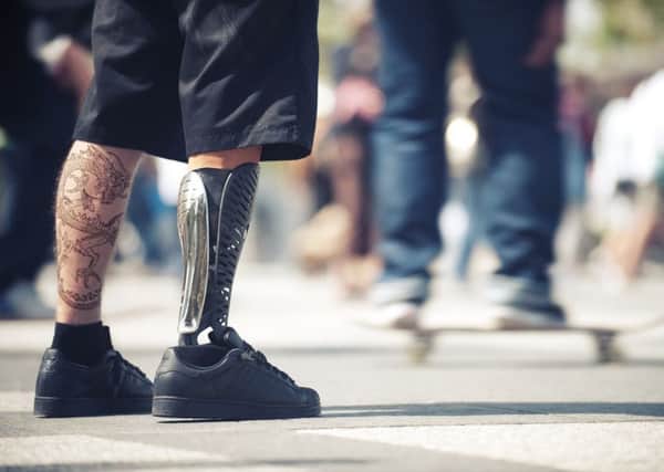 Derry people with prosthetic limbs are invited to a special open day in Musgrave Park Hospital on Saturday.