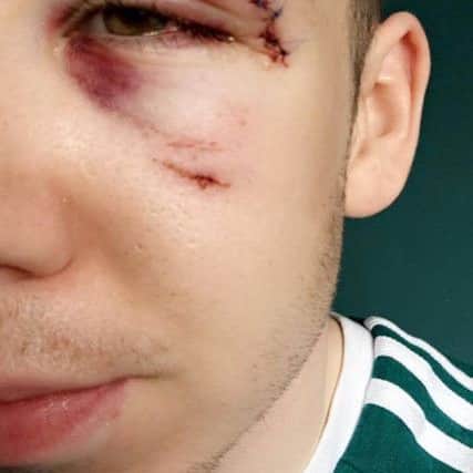 Conol Cassidy claims he was the victim of a homophobic attack in Derry.
